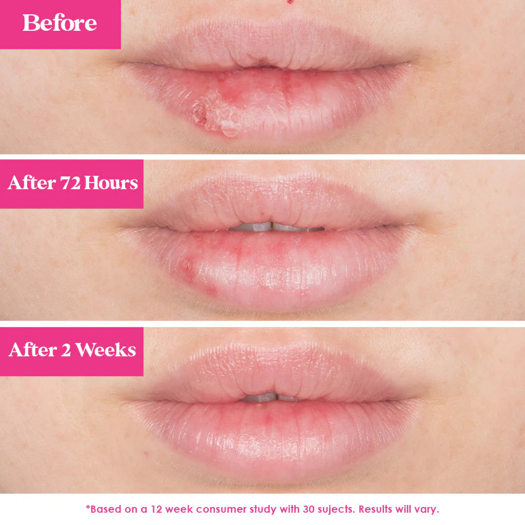 Grande Pout - Lip Plumping Mask