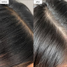 Briogeo Scalp Revival - Charcoal + Tea Tree Buildup Detox Spray