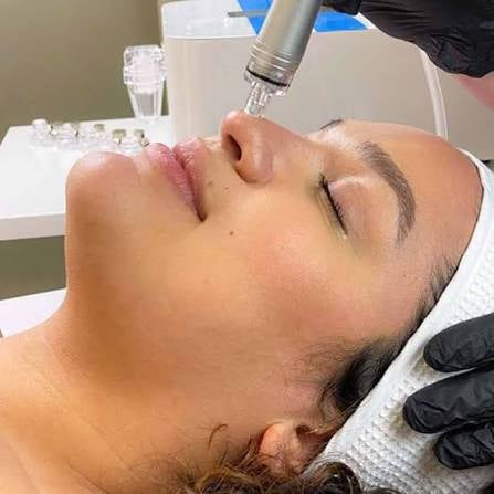 HydroGlow Facial